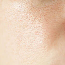 Skin Texture Pores